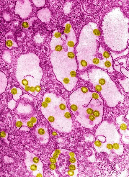 Electron Micrograph Rift Valley Fever Virus Rift Valley Fever Rvf — Fotografia de Stock