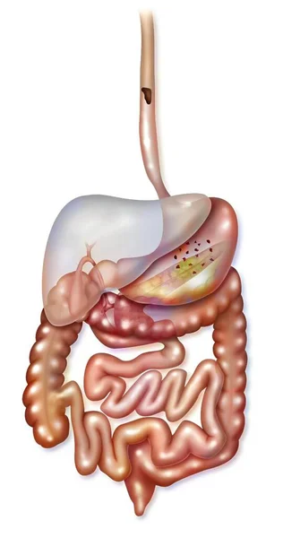 Digestive System Esophagus Stomach Duodenum Small Intestine — Stock Photo, Image