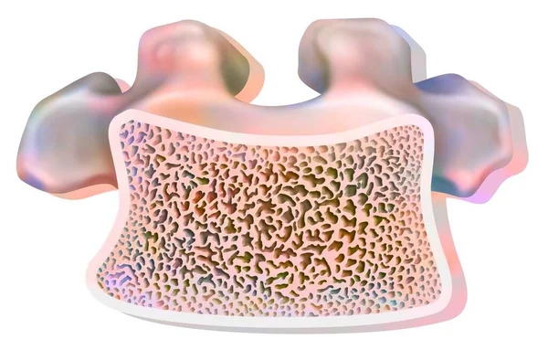Структура Здорового Дорсального Хребця Губчастою Компактною Тканиною — стокове фото