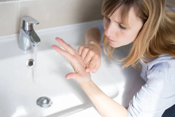 Woman Suffering Contamination Ocd Obsessive Hand Washing — Stok Foto