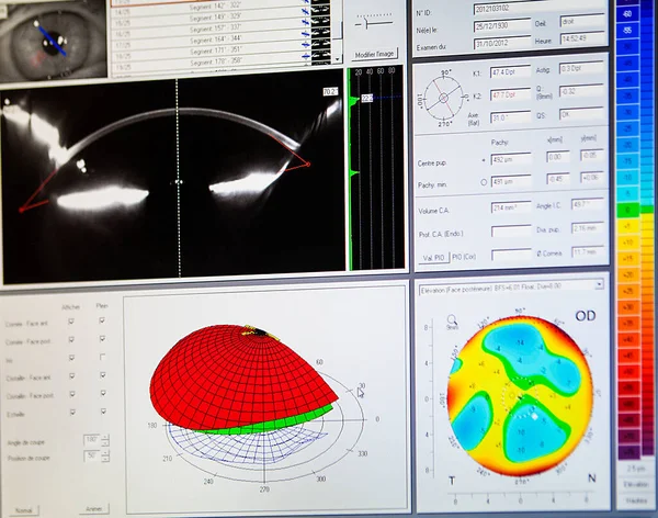 Sections External Analysis Cornea Imaging Obtained Corneal Topographer — Photo