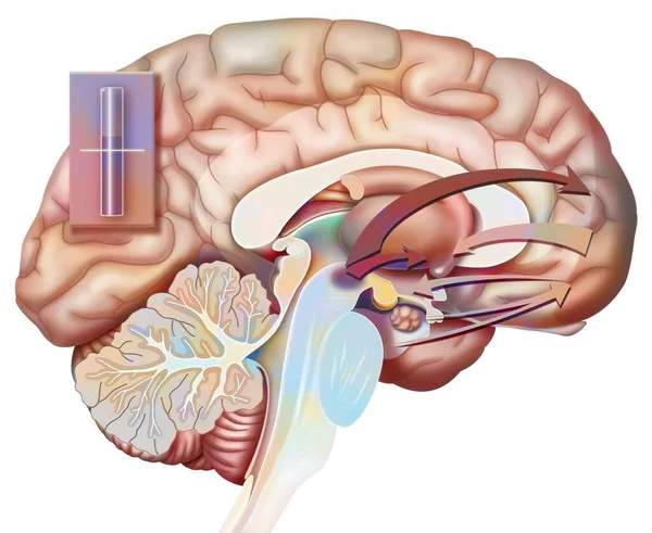 Desire Rupture State Reaction Brain Birth Desire Love — Zdjęcie stockowe