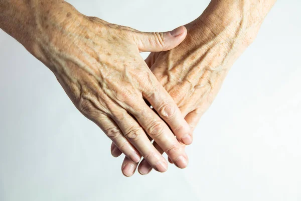 Hands Spots Old Age — Fotografia de Stock