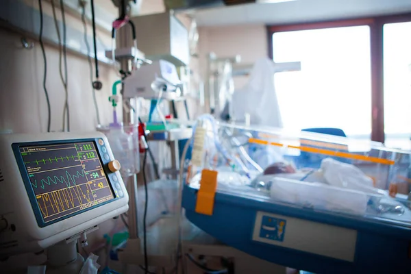 Neonatal Department Newborn Respiratory Distress — Foto Stock
