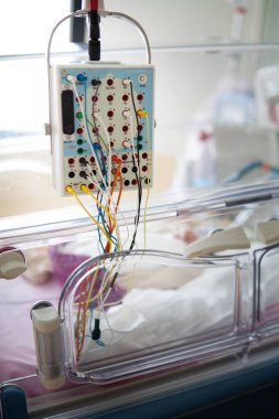 25-week premature baby electroencephalogram to monitor brain development.
