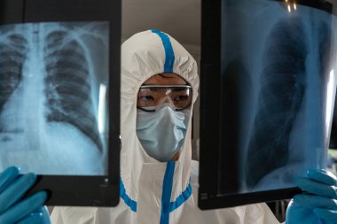 Doctor in a Covid ward of a hospital examining x-rays of the lungs.