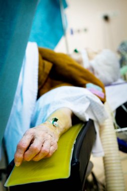 Septic surgery in the operating room, patient's hand.