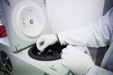Laboratory analyzes and results to test the effectiveness of an AIDS vaccine.
