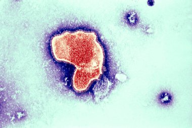 Thic electron micrograph reveals the morphologic traits of the Respiratory Syncytial Virus (RSV). The virion is variable in shape, and size (average diameter of between 120-300nm). RSV is the most common cause of bronchiolitis and pneumonia among inf