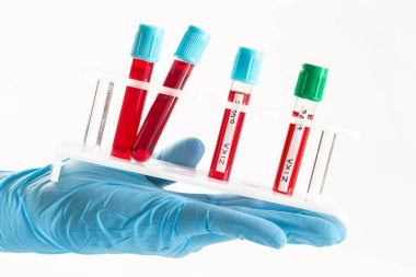 Zika virus analysis isolated on white background