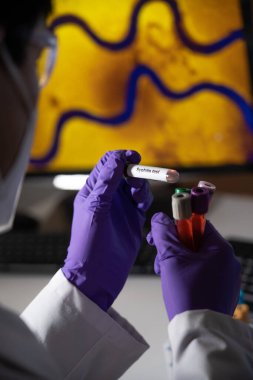 Blood test for syphilis caused by the bacterium treponema pallidum or pale treponema. This infection is sexually transmitted.