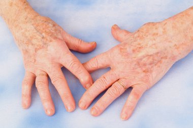 old woman's hands close-up view