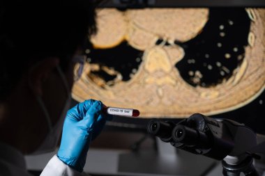 Blood tests for Covid-19 screening and X-ray or CT images of infected patients.