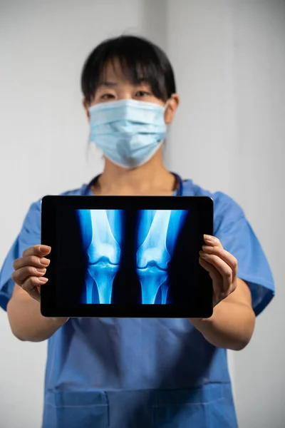 Female Doctor Holding Screen Ray Lungs — Foto de Stock