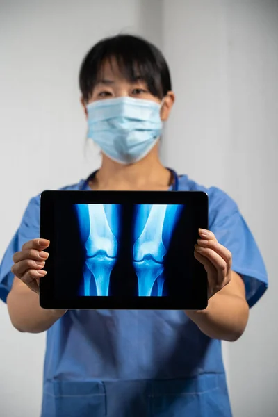 Female Doctor Holding Screen Ray Lungs — Stok fotoğraf