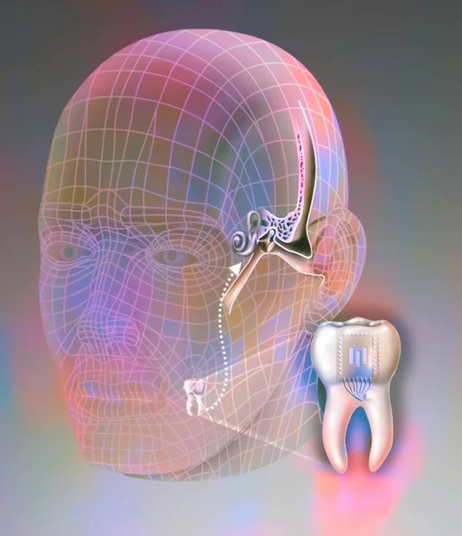 Principle Dental Telephone Sending Waves Tooth Inner Ear — 스톡 사진
