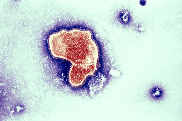 Тиковый электронный микрограф раскрывает морфологические черты респираторного синцитиального вируса (РСВ). Вирион отличается по форме и размеру (средний диаметр от 120 до 300 нм). Ринго является самой распространенной причиной бронхиолита и пневмонии среди инфузоров.