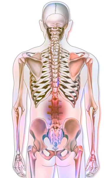 Σύστημα Οστών Ανθρώπινος Σκελετός Παραστάσεις Οσφυϊκού Πόνου — Φωτογραφία Αρχείου