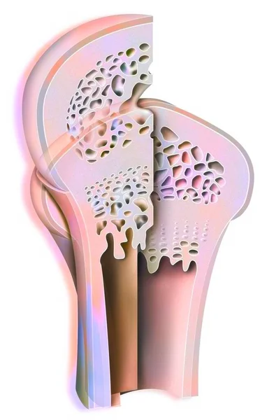 Development Long Bone Epiphysis Widens Grows Head Becomes Rounded — Stock Photo, Image