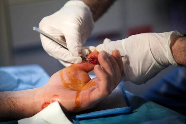 Mountain Doctor Stitches Patient Open Dislocation Thumb Ski Fall — Fotografia de Stock