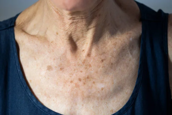 Neck Old Woman — Photo