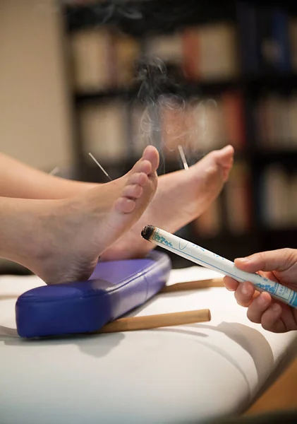 Therapist specializing in traditional Chinese medicine practicing acupuncture and moxibustion.