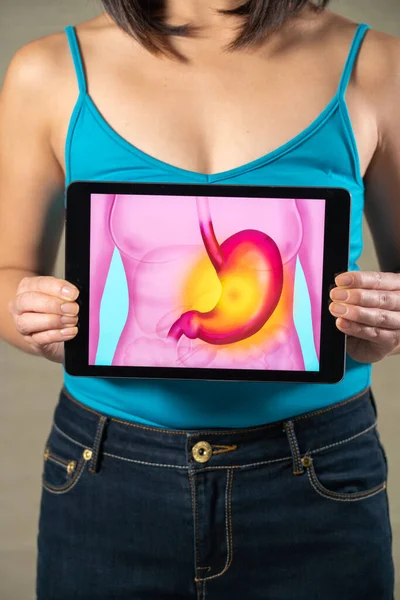 Woman Holding Screen Drawing Stomach Gastric Ulcer — 스톡 사진