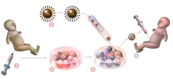 Gene Therapy Introduction Retroviruses Modify Mutated Spinal Cord Cells Newborn —  Fotos de Stock