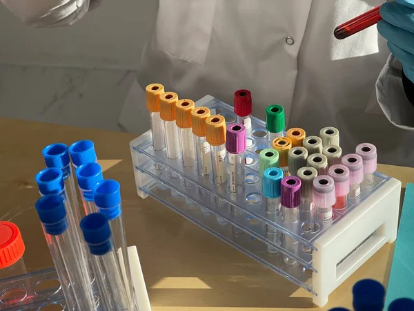 Laboratory Technician Carrying Out Experiments Different Types Viruses Bacteria — Fotografia de Stock