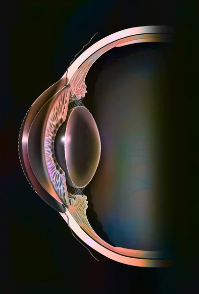 Astigmatic Eye Ovoid Non Spherical Cornea Inducing Distorted Vision — Stockfoto