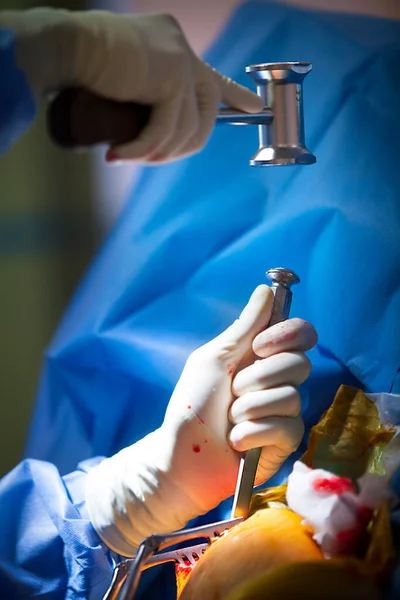Orthopedic Surgery Operating Room Acromioplasty Tenodesis Biceps —  Fotos de Stock