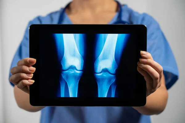 Female Doctor Holding Screen Ray Lungs — ストック写真