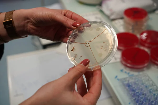 Research Chronic Bacterial Infections Inserm Student Working Bacteriological Infections — Foto Stock