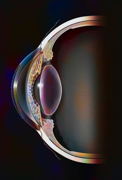 Astigmatic Eye Ovoid Non Spherical Cornea Inducing Distorted Vision — Stock Photo, Image