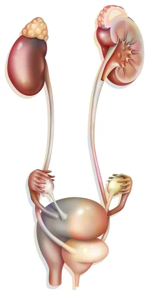 Urogenital System Women Bladder Kidney Ovaries — Zdjęcie stockowe