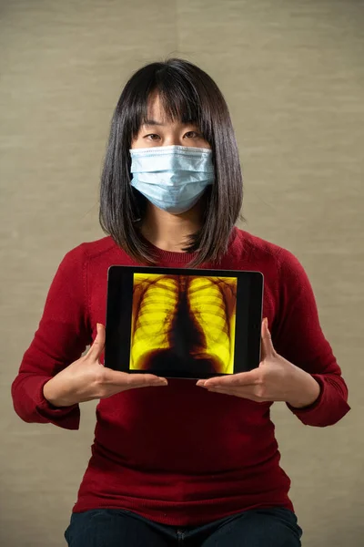 Woman Holding Screen Radio Image Lungs — Stock Photo, Image