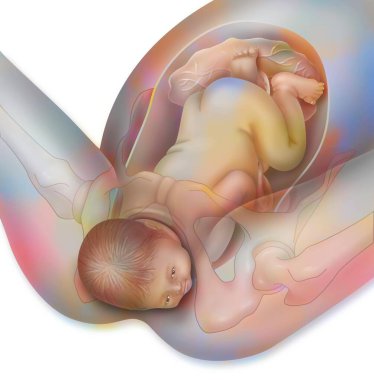 Childbirth, step 3: the baby's head is out.