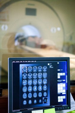 MRI in a hospital radiology department.