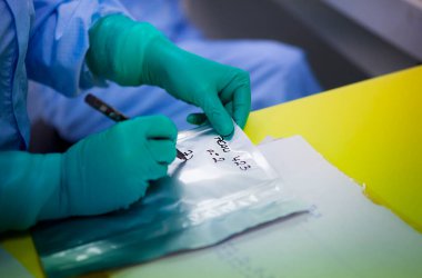 Skin taken from donors and sent to the biobank, preparation of skin samples.