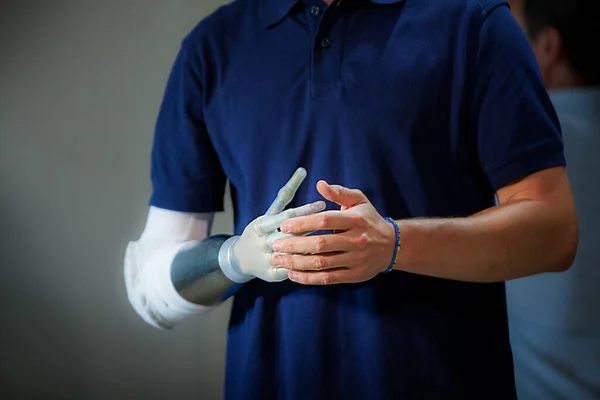 Man Equipped Robotic Arm Prosthesis — ストック写真