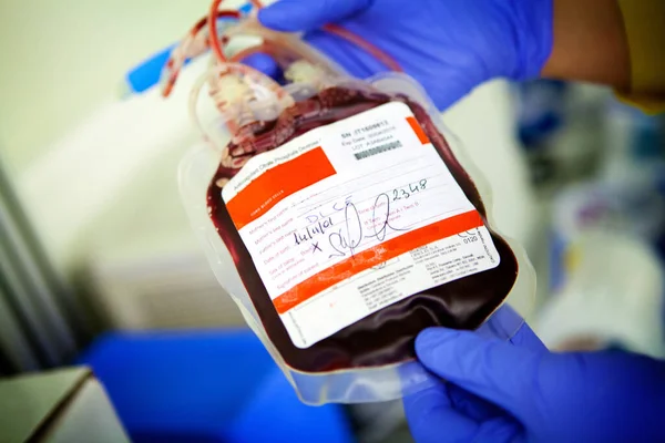 Biobank Bag Containing Cord Blood Stem Cells Hematopoietic Stem Cells — Foto Stock