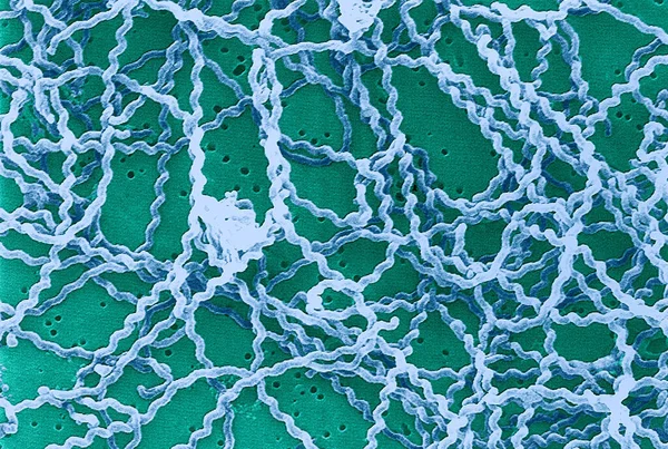 Scanning Electron Micrograph Leptospira Bacteria Polycarbonate Filter Leptospira Known Cause — Fotografia de Stock