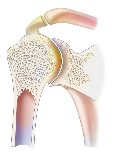 Healthy Ankle Hemophilic Arthropathy Frontal Cut — Foto Stock