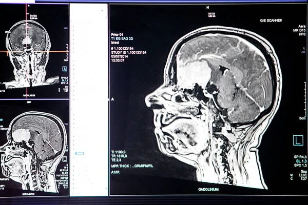 Brain Images Obtained Mri Radiology Department Hospital — Stock Photo, Image