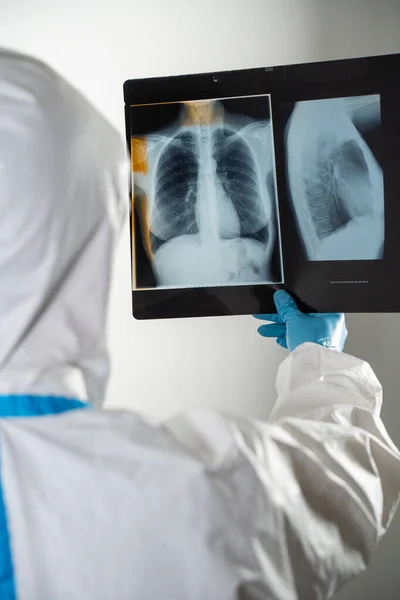 Doctor Covid Ward Hospital Examining Rays Lungs — Photo
