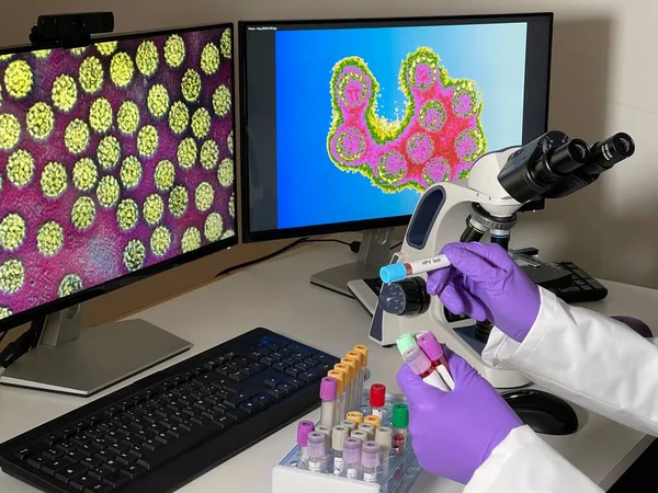 Laboratory Assistant Doing Research Papillomavirus Images Computer — Foto Stock