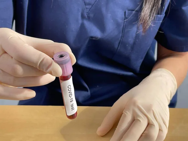 Covid Serological Test Blood Test Look Presence Antibodies — Fotografia de Stock