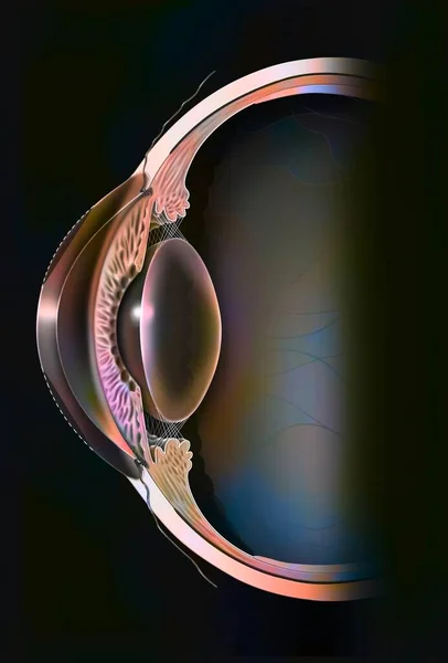 Eye Surgery Refractive Photokeratectomy Case Hyperopic Eye — Stockfoto