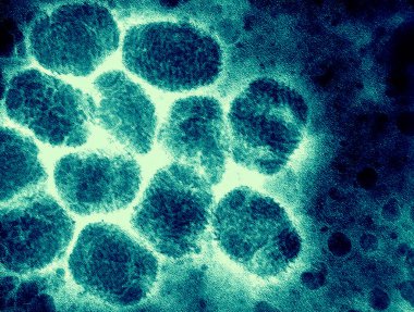 A transmission electron micrograph of smallpox viruses. Smallpox is a serious, highly contagious, and sometimes fatal infectious disease. There is no specific treatment for smallpox disease, and the only prevention is vaccination.