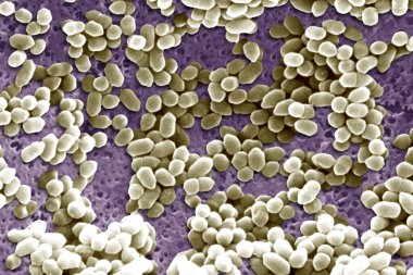 listeria ivanovii, SEM altında görüntülendi.